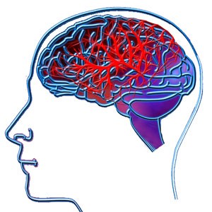 פגיעת ראש וצוואר סיכון לשבץ מוחי