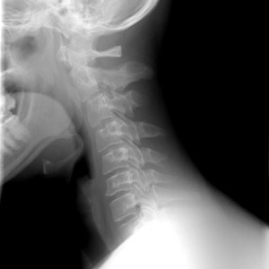 מבנה הצוואר אנטומיה וביומכניקה