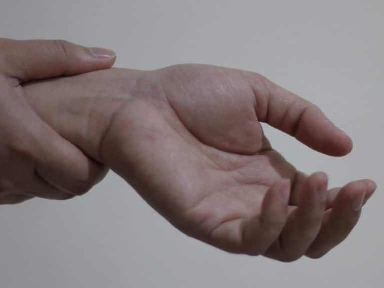 מבנה כף היד אנטומיה ותנועה