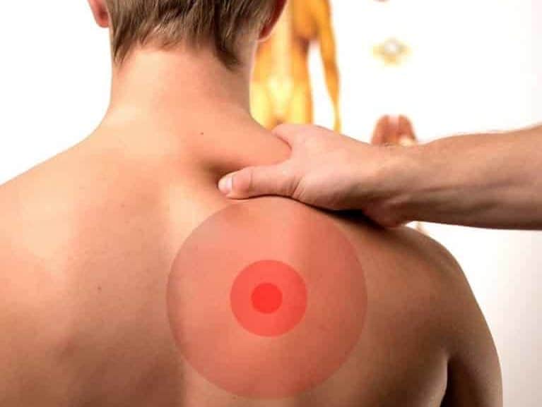 דלקת בגב העליון: גורמים אבחון וטיפול