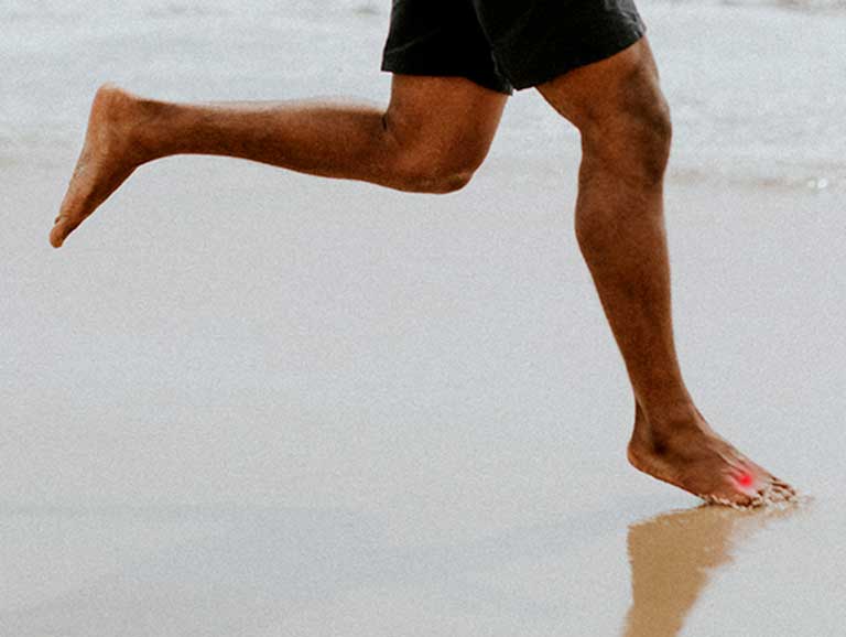 כיצד למנוע כאבי ריצה בכפות הרגליים