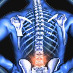 MRI לאבחון כאבי גב