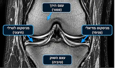 MRI לברך: מתי הבדיקה נחוצה ומה היא מגלה? 3 MRI לברך: מתי הבדיקה נחוצה ומה היא מגלה?