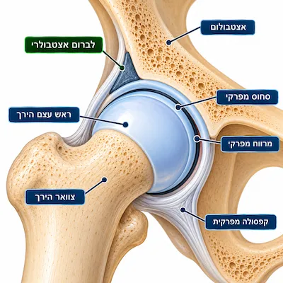 MRI למפרק הירך: מתי הבדיקה נחוצה ומה היא מגלה?