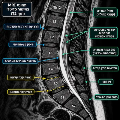 פענוח MRI של עמוד השדרה: מה משמעות הממצאים?